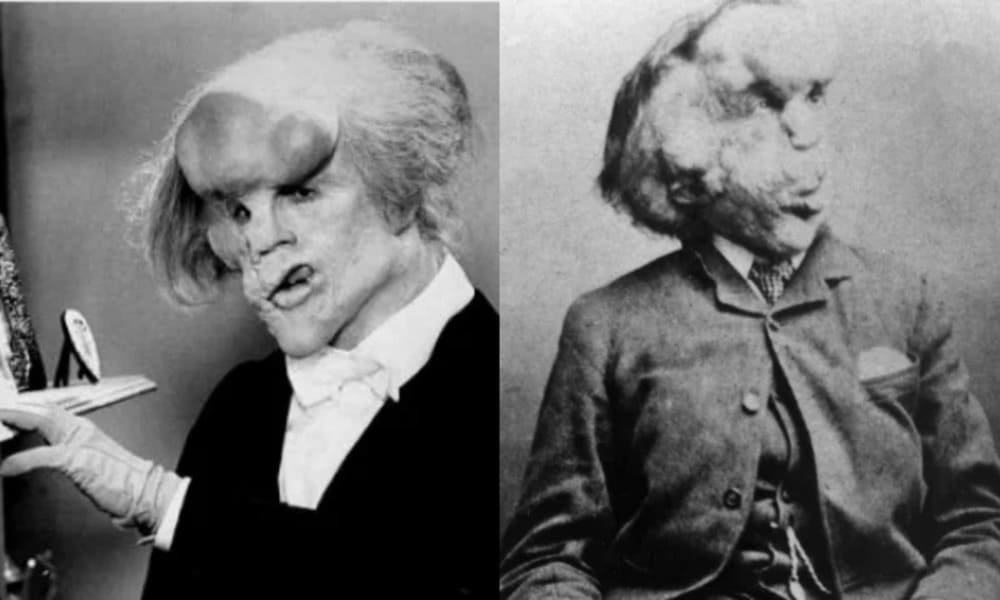 John Hurt - Joseph Merrick - Jack Huston